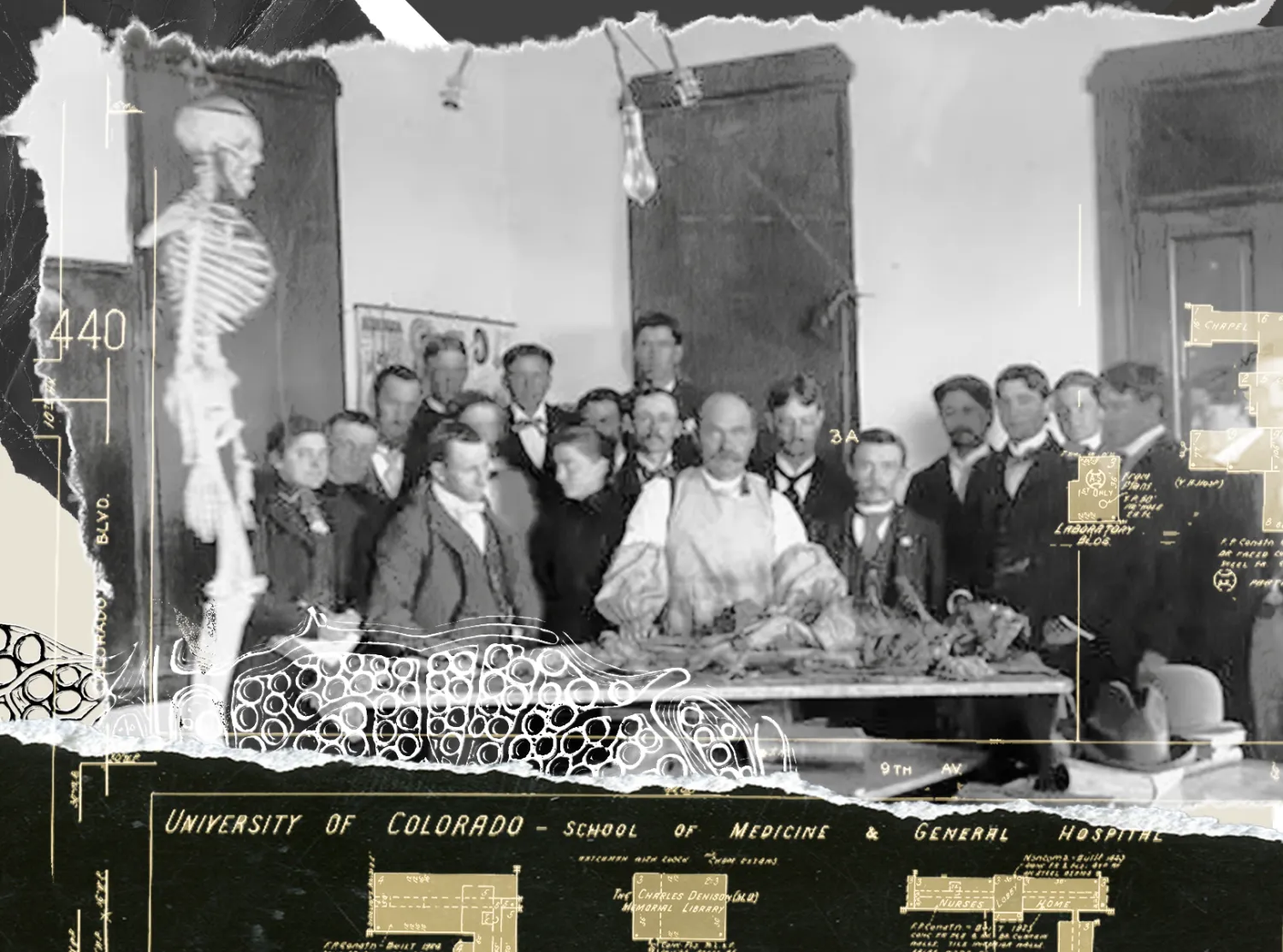 Old photograph of medical students in an anatomy lab with collage overlays of a map of the hospital location in denver and a medical illustration. 